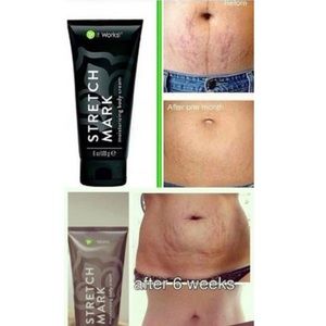 Stretch mark cream